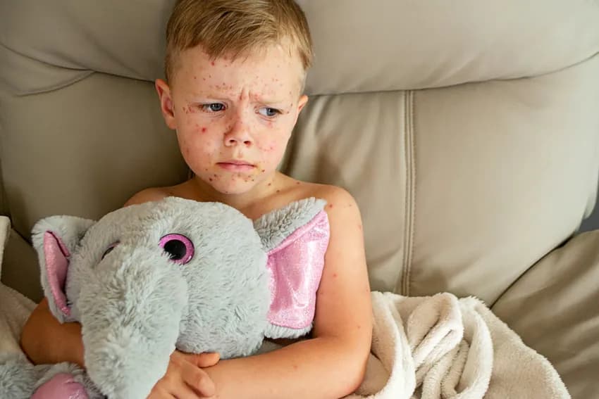 All You Need to Know About the Chickenpox Vaccine Near You